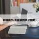 新疆病例(新疆病例单子图片)